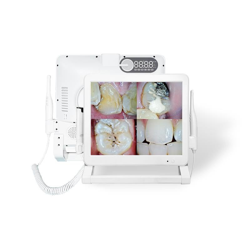 Say goodbye to traditional dental x-rays with WiFi Intraoral Camera