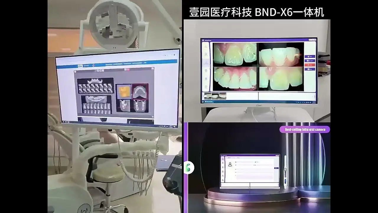 Hot selling touch screen endoscope computer oral camera built-in dedicated software