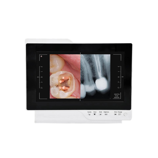 Experience an enhanced dental visit with a dental camera intraoral