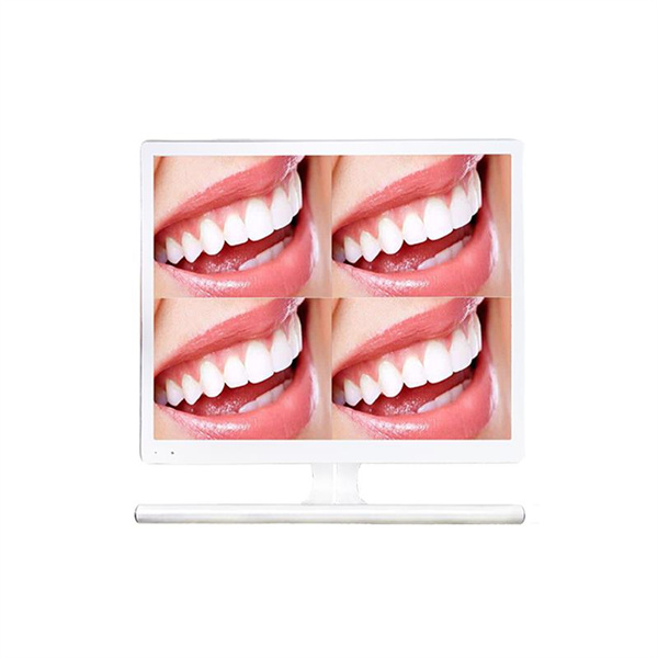 Enhancing Patient Understanding with Intraoral Camera Technology