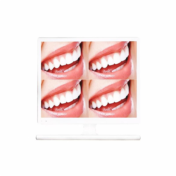 See what your dentist sees with the help of a powerful intra oral camera.