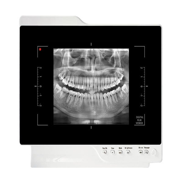 Experience True Vision with Camera Teeth