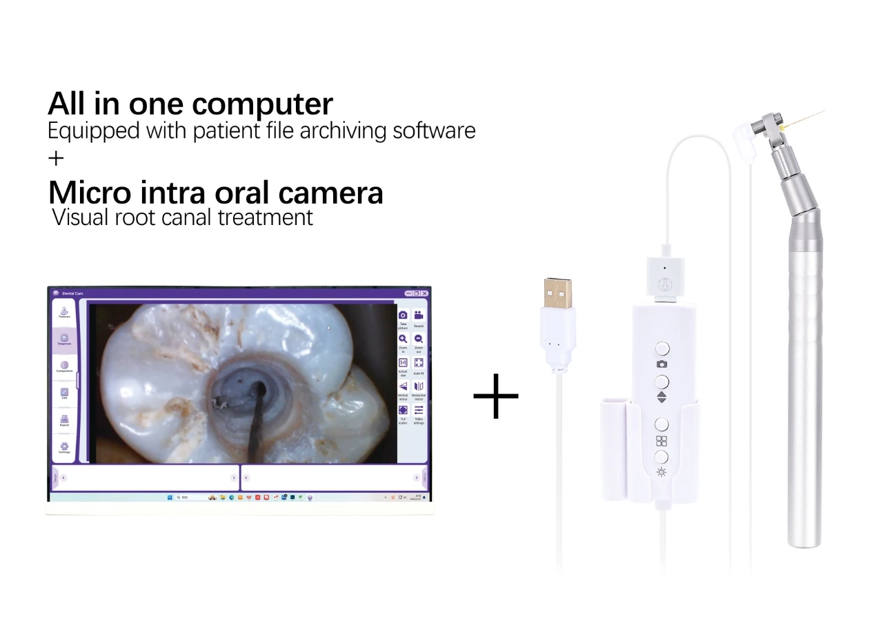Dental Root canal Viewing Instrument Macro Camera with Pedal Dental Equipment Dental Clinic Treatment Equipment 5