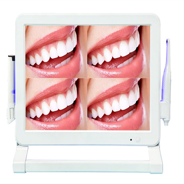 Discover hidden dental issues with the help of a dental camera intraoral