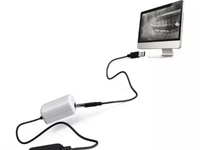 The Benefits of Digital RVG Sensors in Dental Radiography