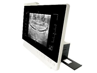 Investing in Oral Camera & Monitor & Loupe: A Long-Term Benefit for Clinics