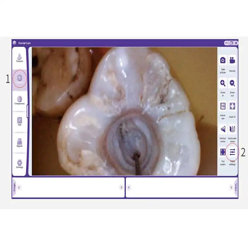 T9 New Dental Intra Oral Camera Wifi Screen Visual Root Canal Removal/mouth Mirror/Endo Motor Treatment High Allocation 4