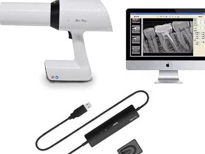 The Future of Intraoral Cameras in Digital Dentistry
